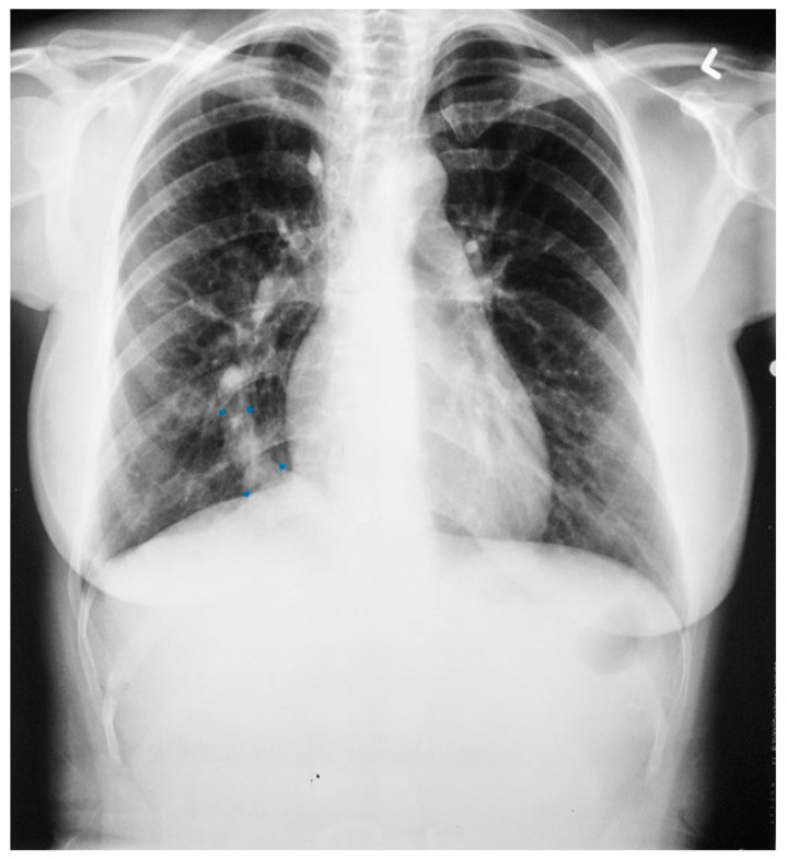 Figure 7