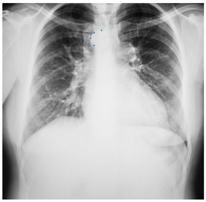 Figure 9