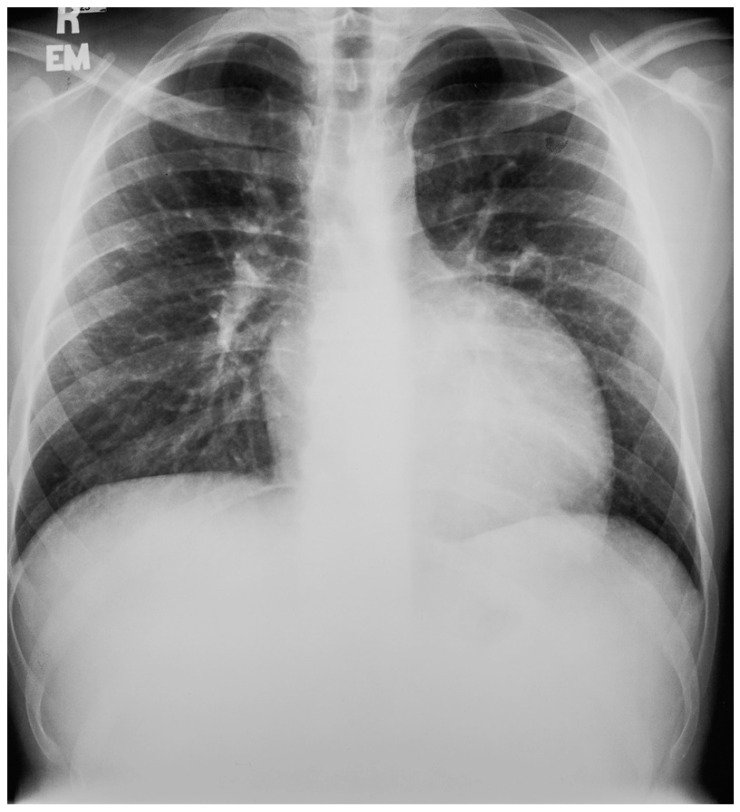 Figure 12