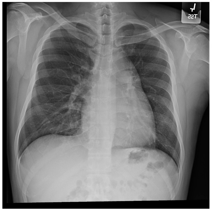 Figure 13