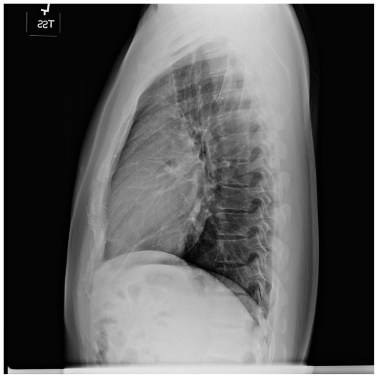 Figure 14