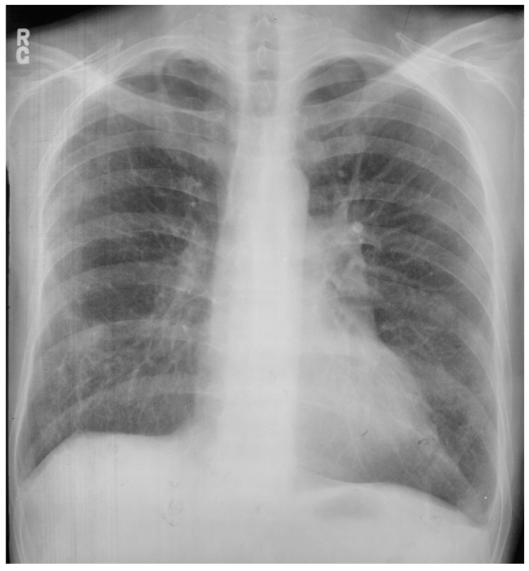 Figure 15