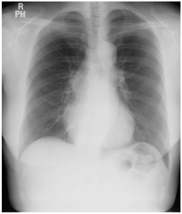 Figure 16