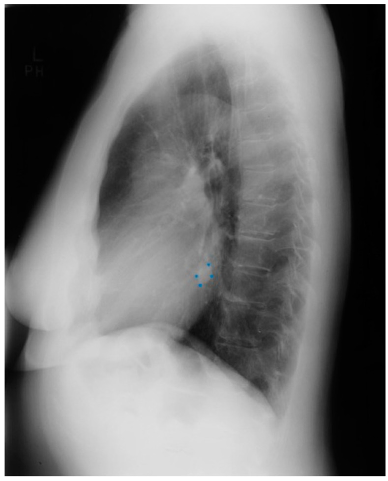 Figure 17