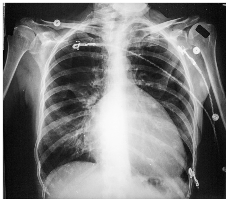 Figure 18