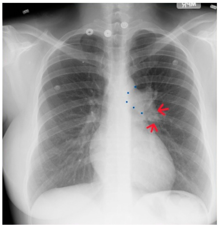 Figure 19
