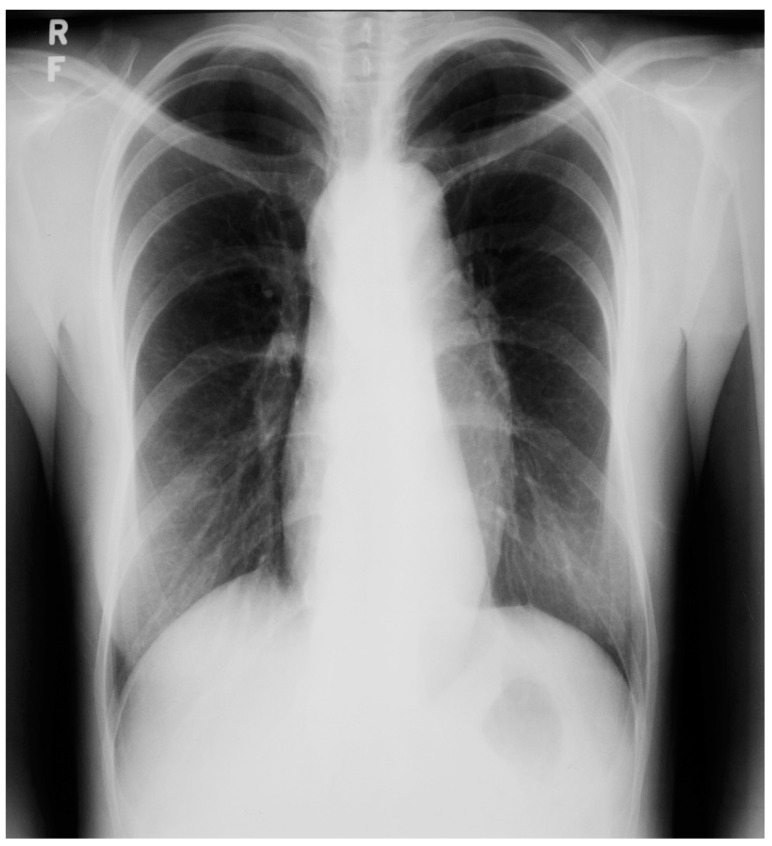 Figure 20