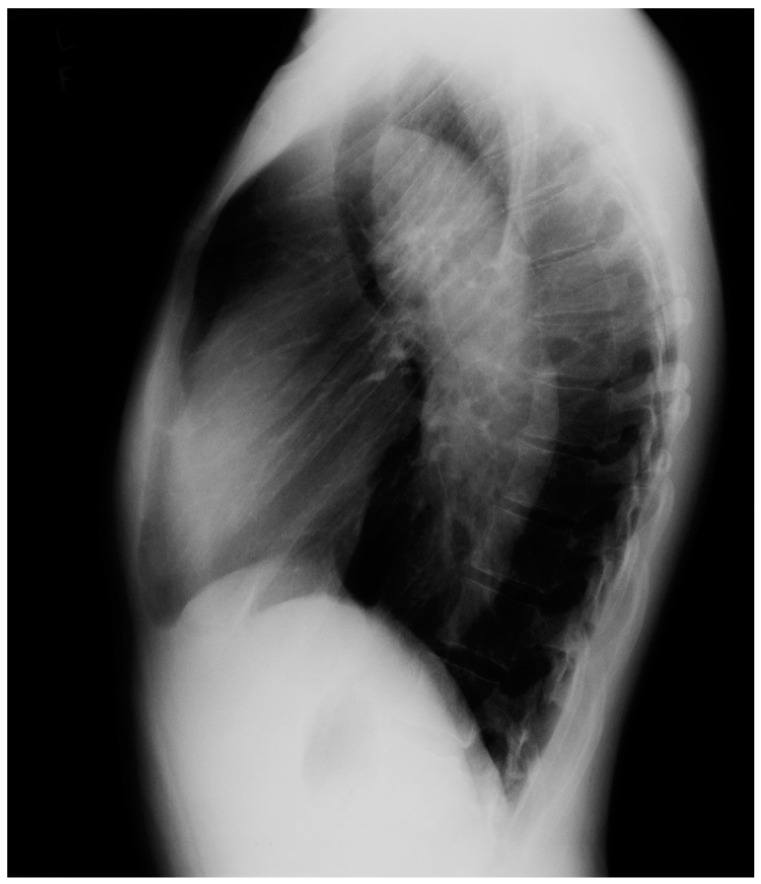 Figure 21