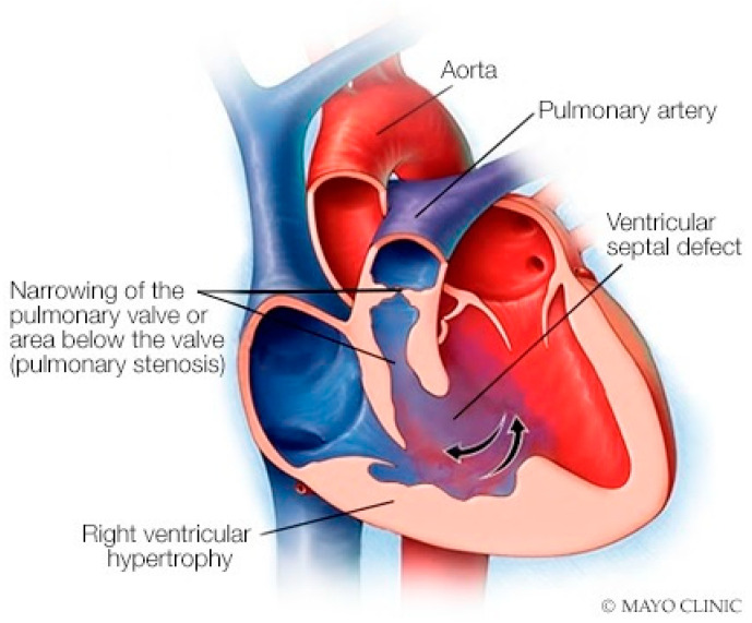 Figure 22