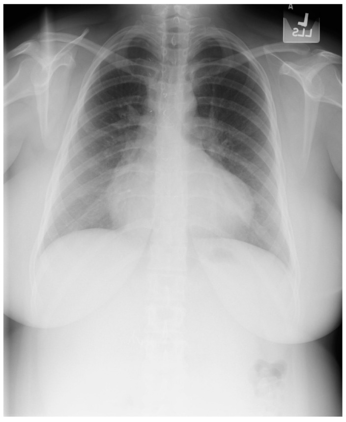 Figure 23