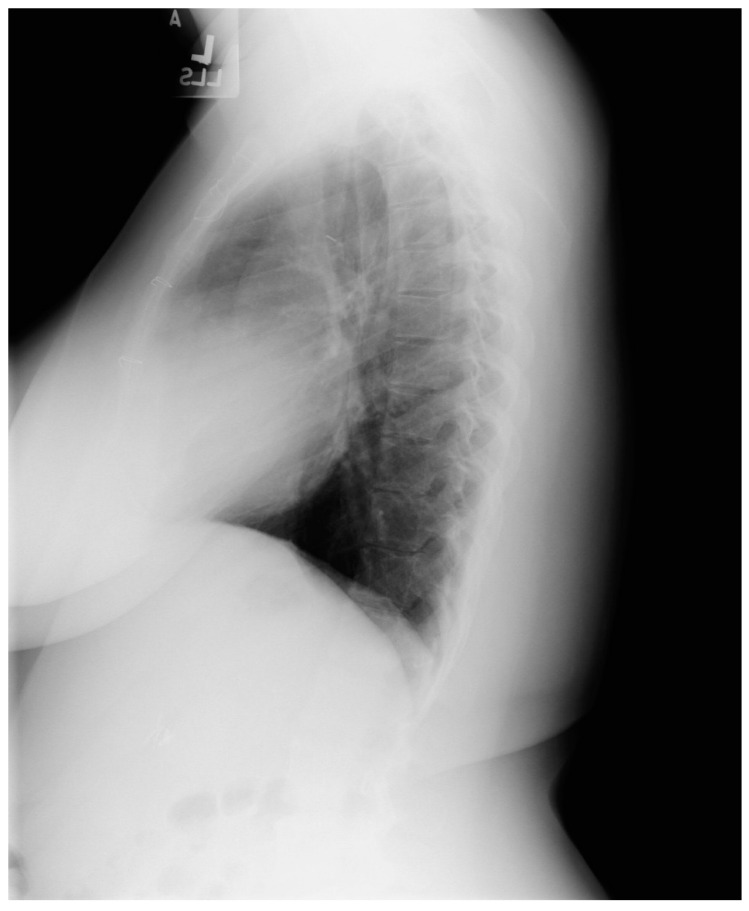 Figure 24
