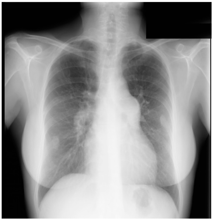 Figure 25