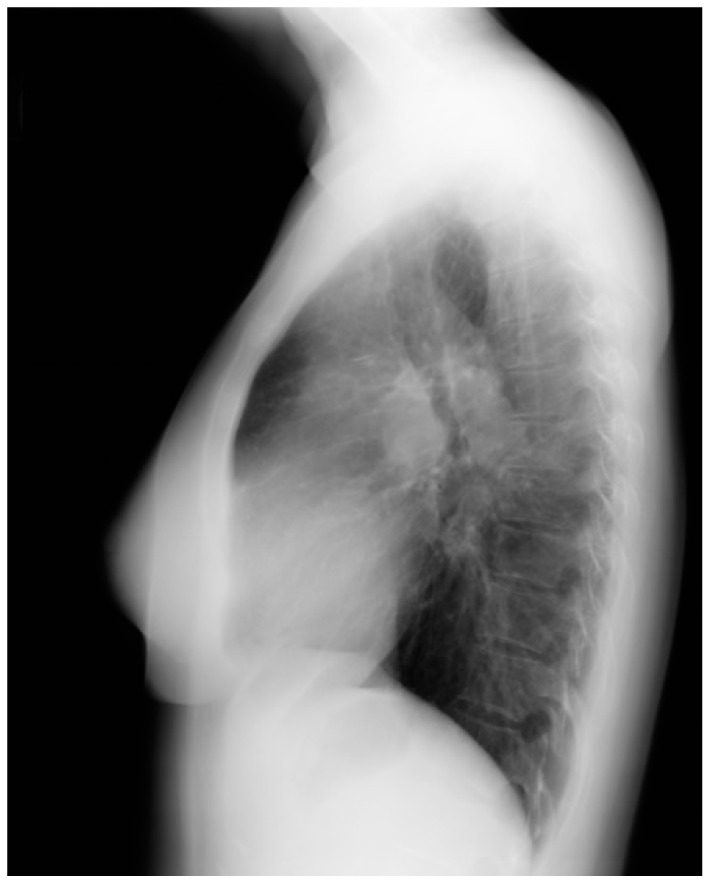 Figure 26