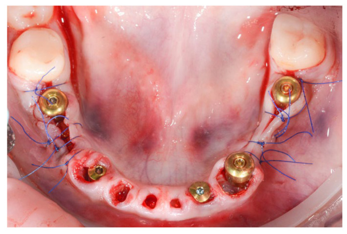 Figure 12