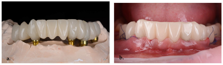Figure 13
