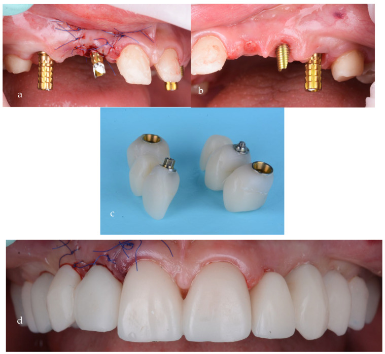 Figure 15