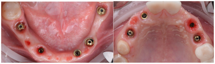 Figure 16