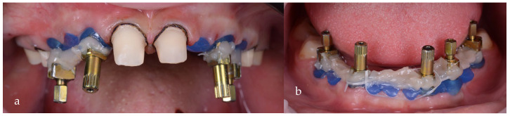 Figure 17