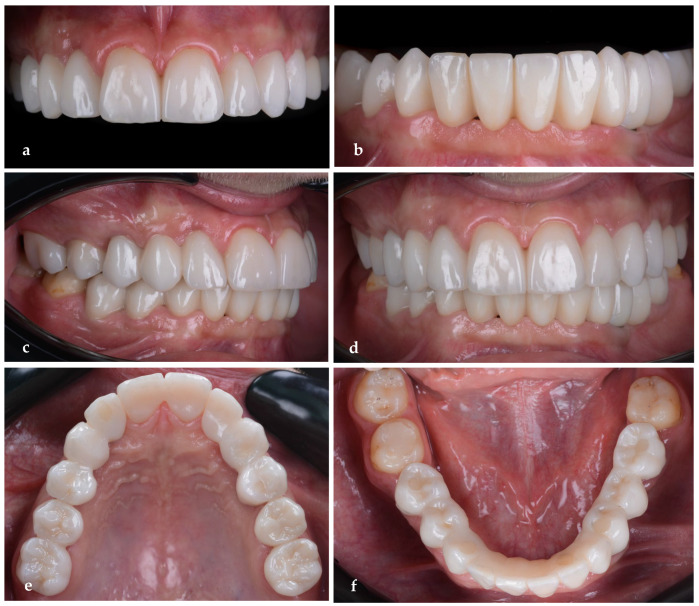 Figure 18