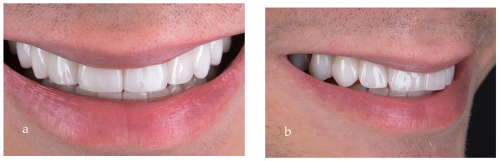 Figure 19