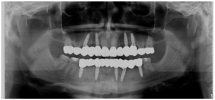 Figure 21