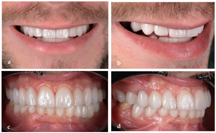 Figure 22
