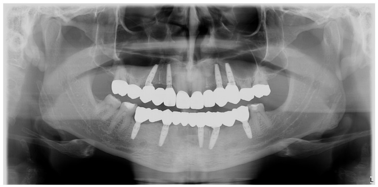 Figure 23