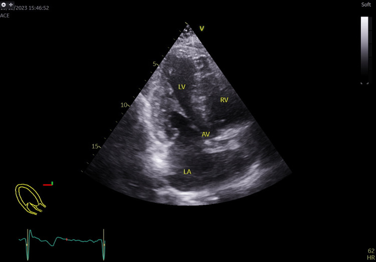 Figure 5