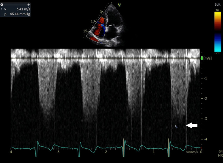 Figure 9