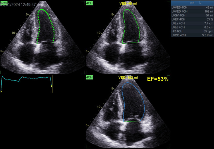 Figure 10