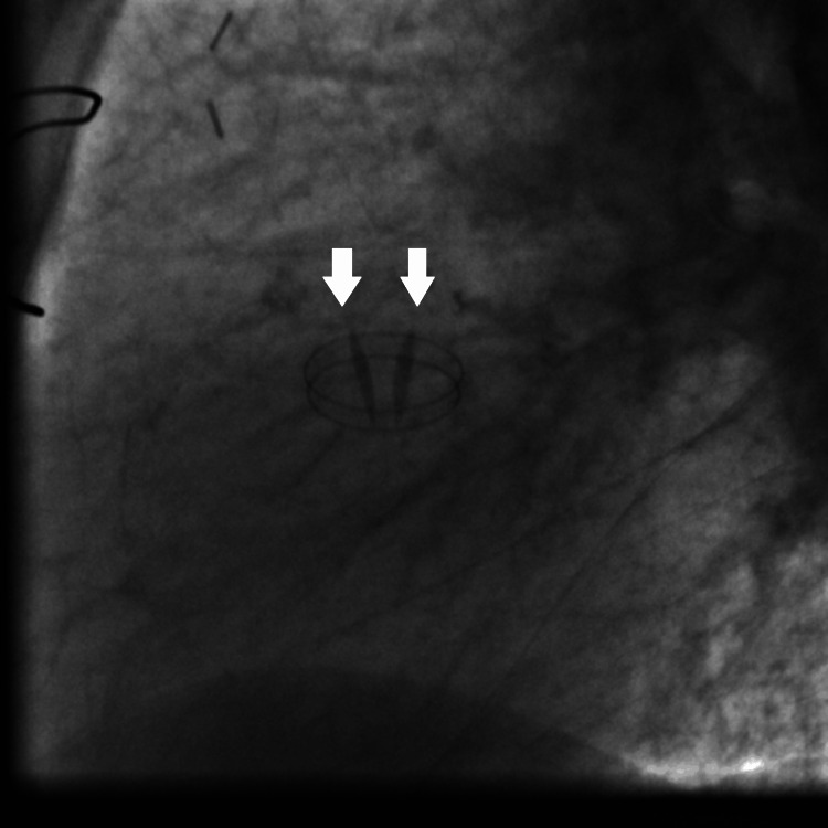 Figure 11