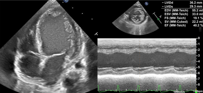 FIGURE 4