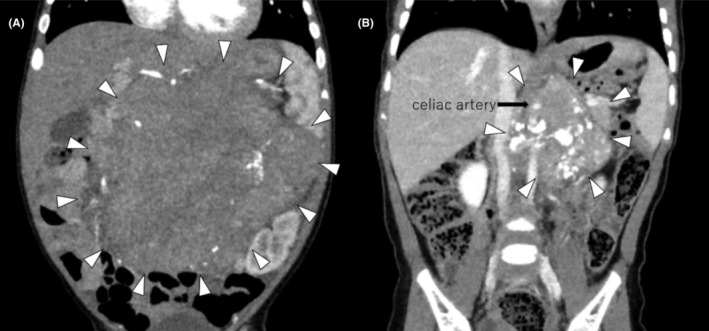 FIGURE 3