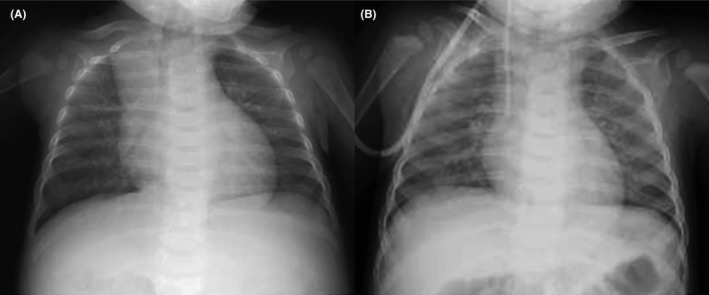 FIGURE 1