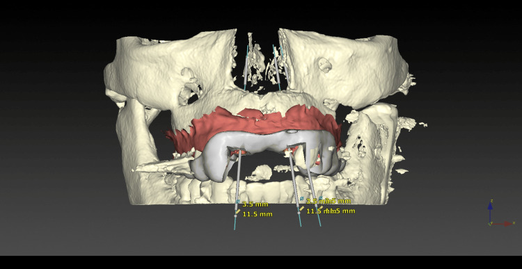 Figure 6