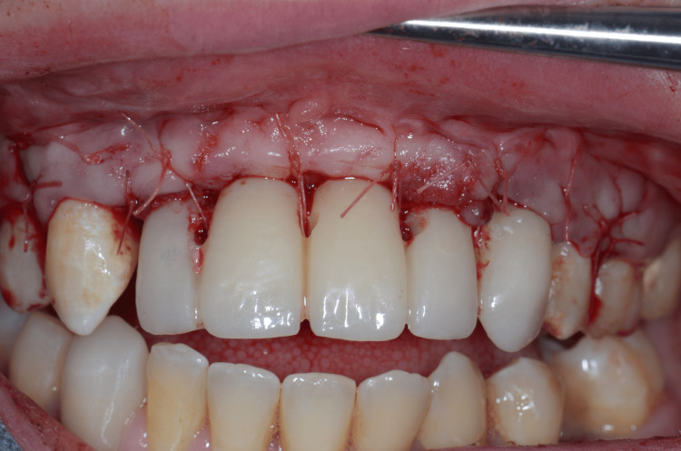 Figure 13
