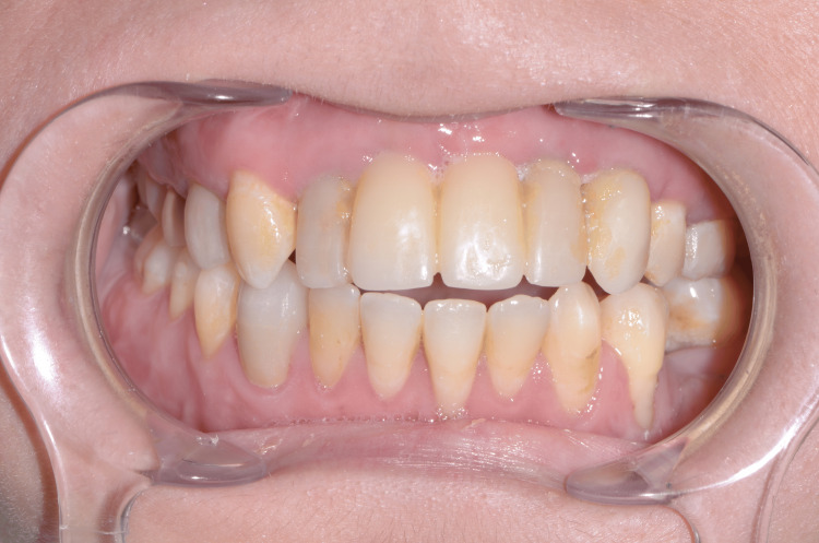 Figure 14