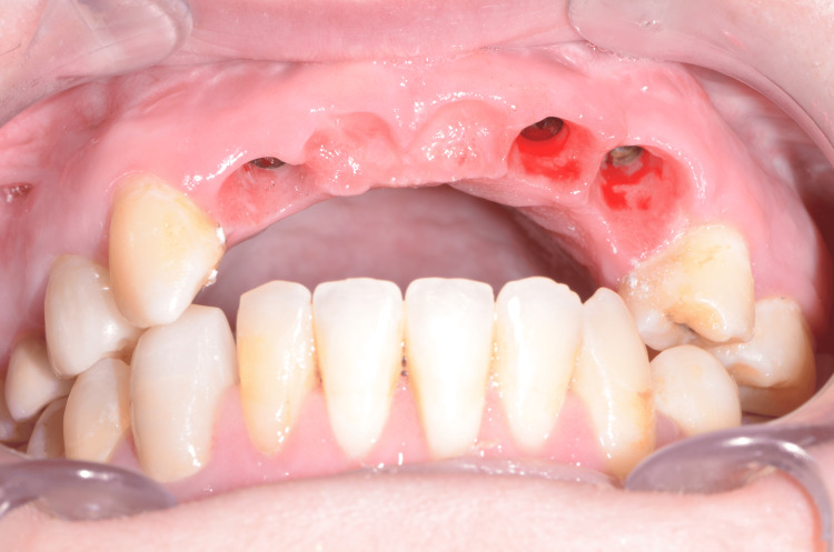 Figure 15