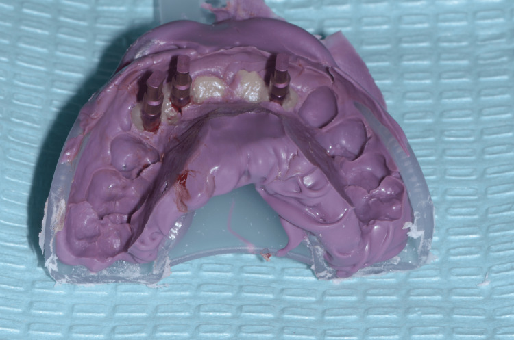Figure 18