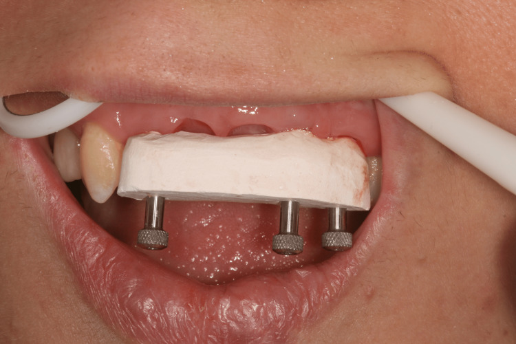 Figure 19