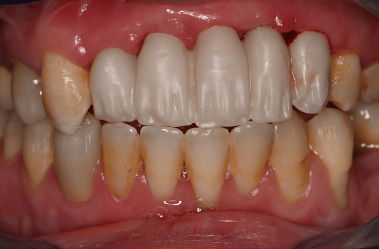Figure 20