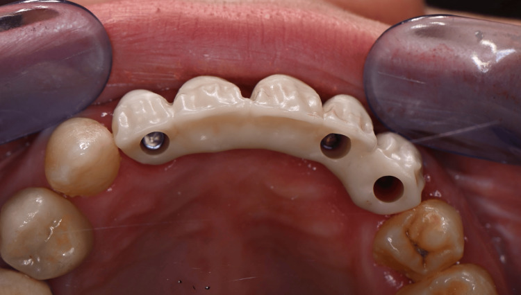 Figure 21