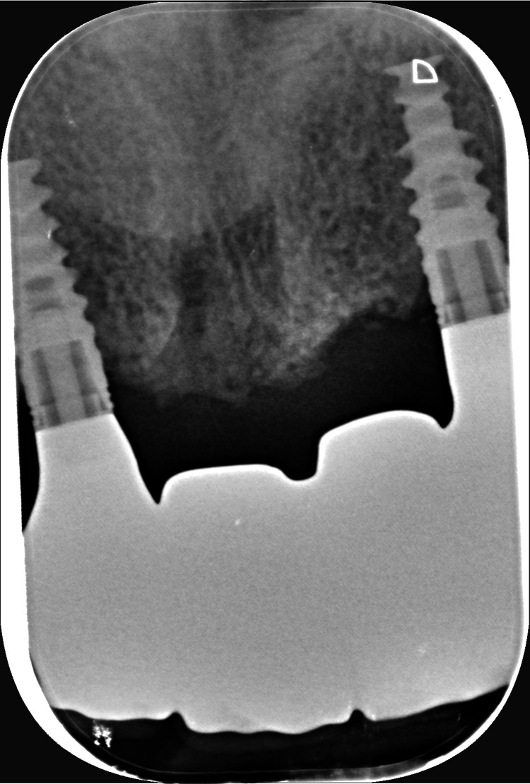 Figure 22