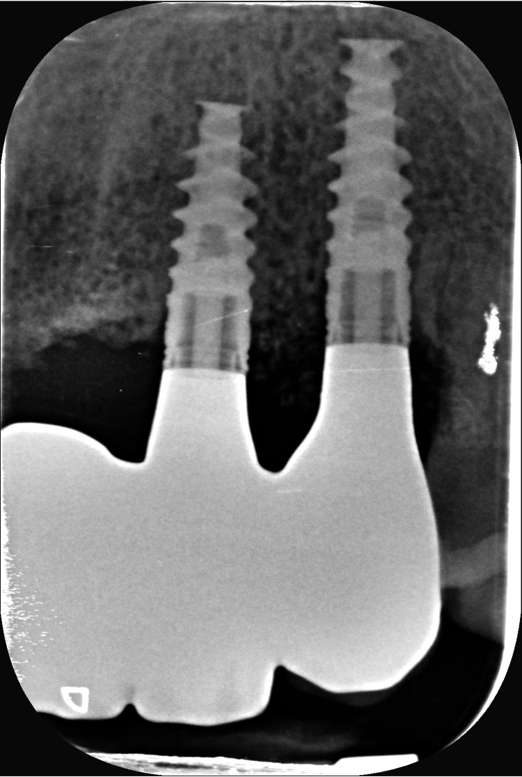 Figure 23