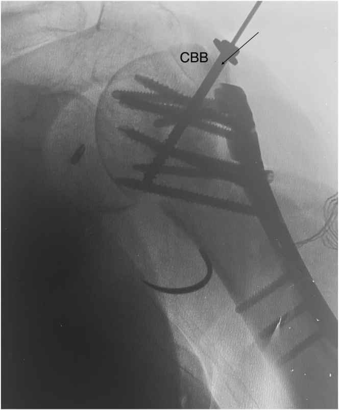 Figure 9