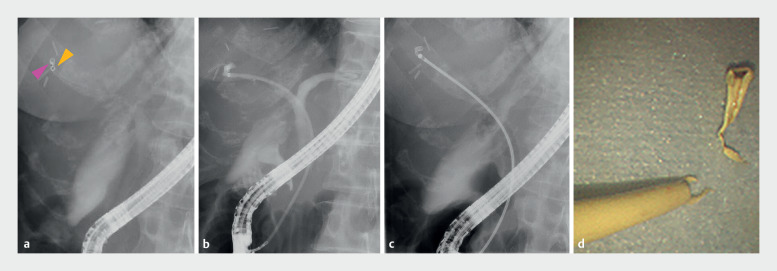 Fig. 5