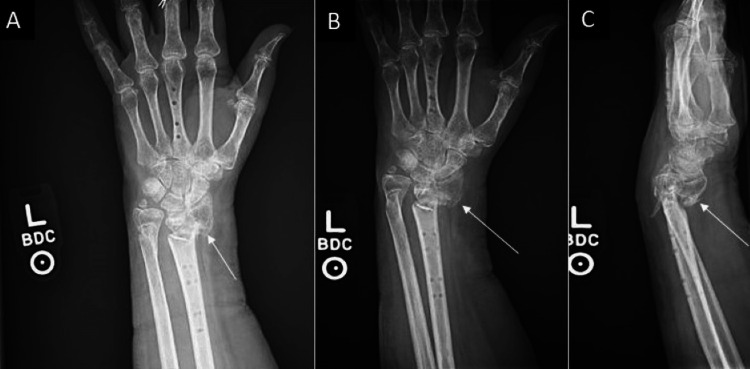 Figure 6