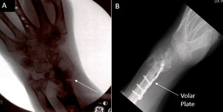 Figure 10