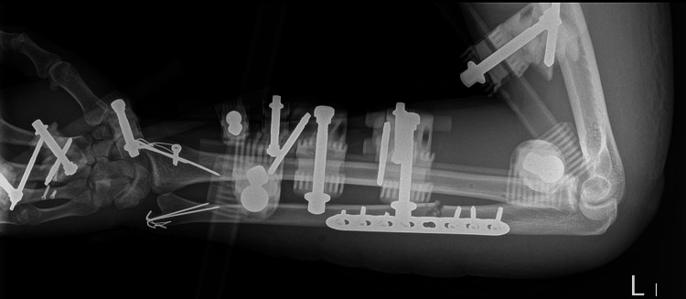 Figure 6