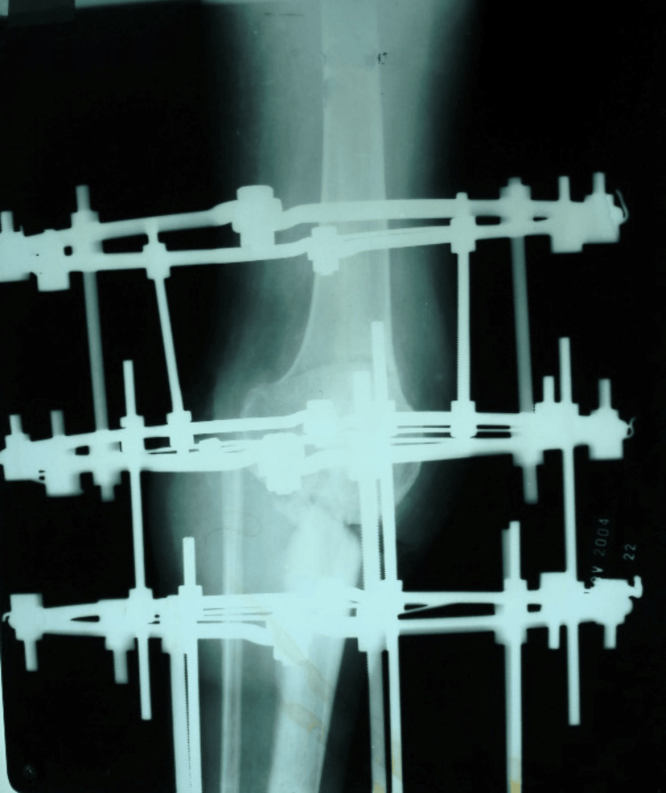 Figure 5